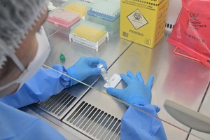 Fiocruz e UFRJ desenvolvem novo teste rápido para hantavirose