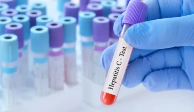 Hepatite C: Novo teste rápido de 15 minutos pode melhorar tratamento