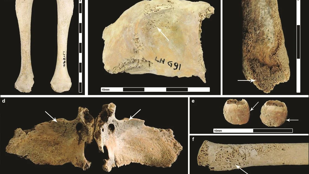 Urbanismo romano foi prejudicial à saúde pública, segundo estudo