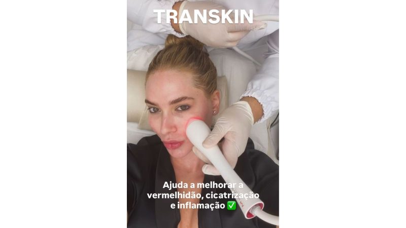 Virginia fez alguns procedimentos, como o Transkin. - Virginia Fonseca/@virginia/Instagram