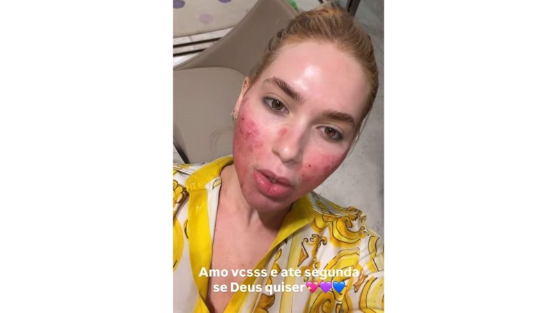 Ela agradeceu o carinho dos fãs e se despediu pelos stories. - Virginia Fonseca/@virginia/Instagram