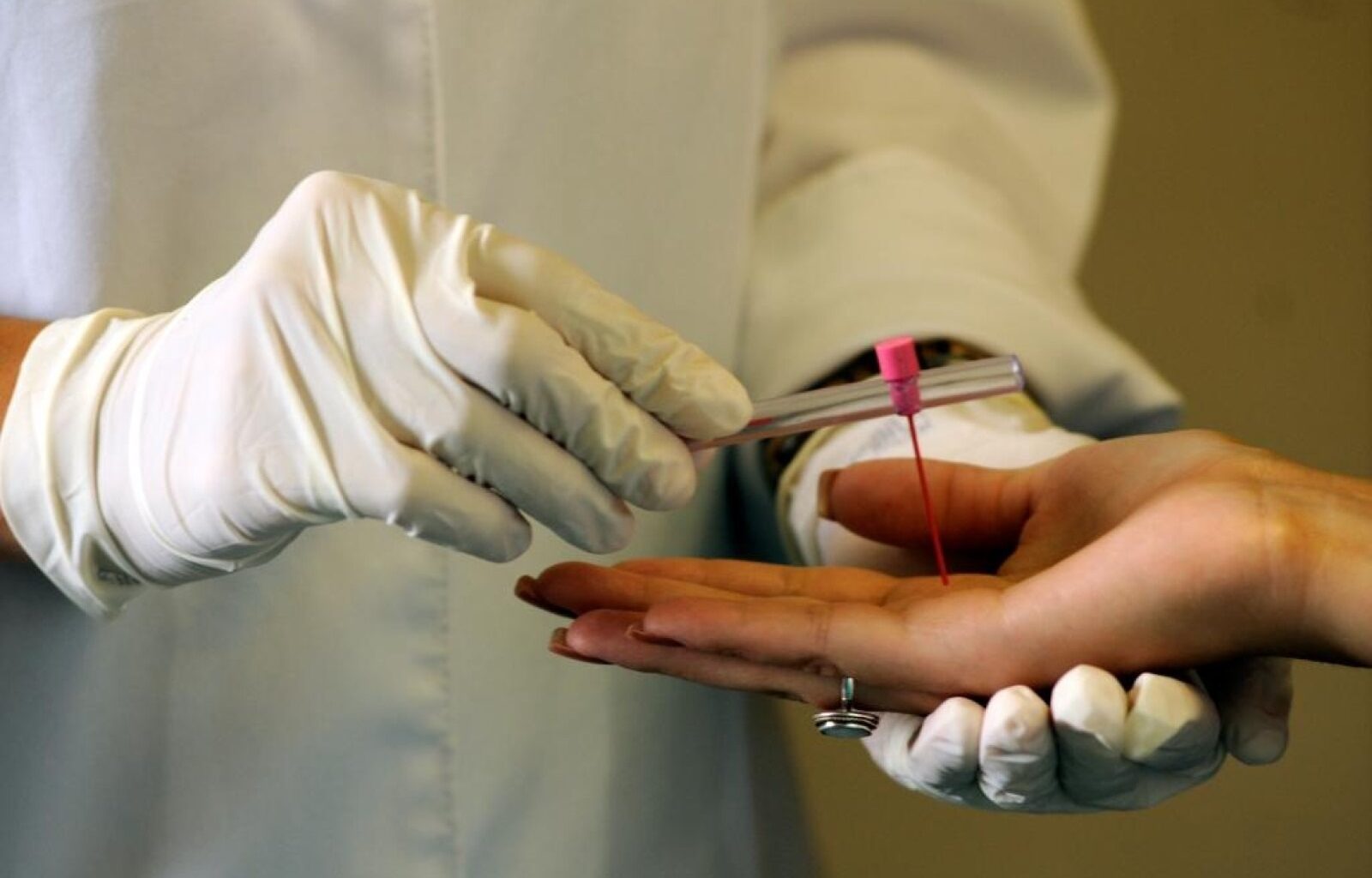 Secretaria Estadual de Saúde reforça ações para enfrentar a hanseníase em Mato Grosso