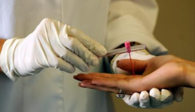 Secretaria Estadual de Saúde reforça ações para enfrentar a hanseníase em Mato Grosso