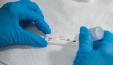 novo medicamento contra HIV auxilia nas alternativas para prevenção