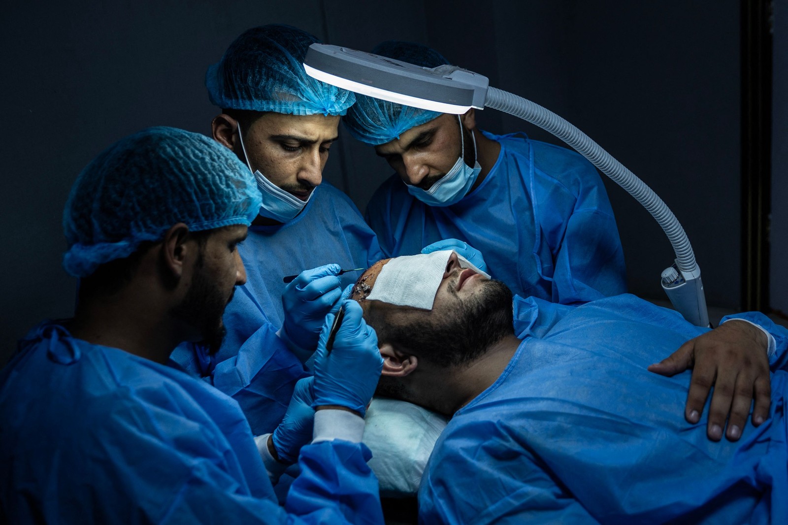 Equipe cirúrgica realiza transplante capilar em um afegão em uma clínica de estética em Cabul. — Foto: Wakil KOHSAR / AFP