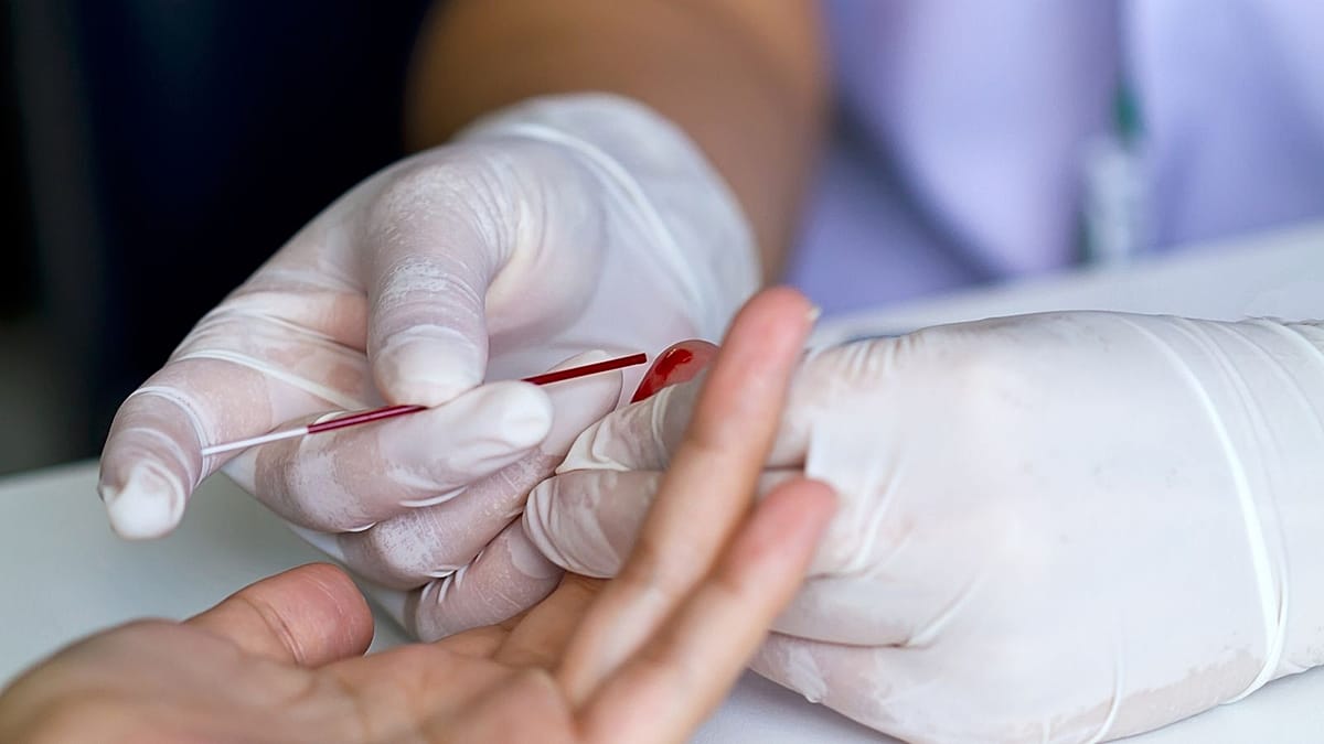 Novo exame de sangue por via de picada no dedo pode ajudar a detetar Alzheimer a partir de amostra recolhida em casa