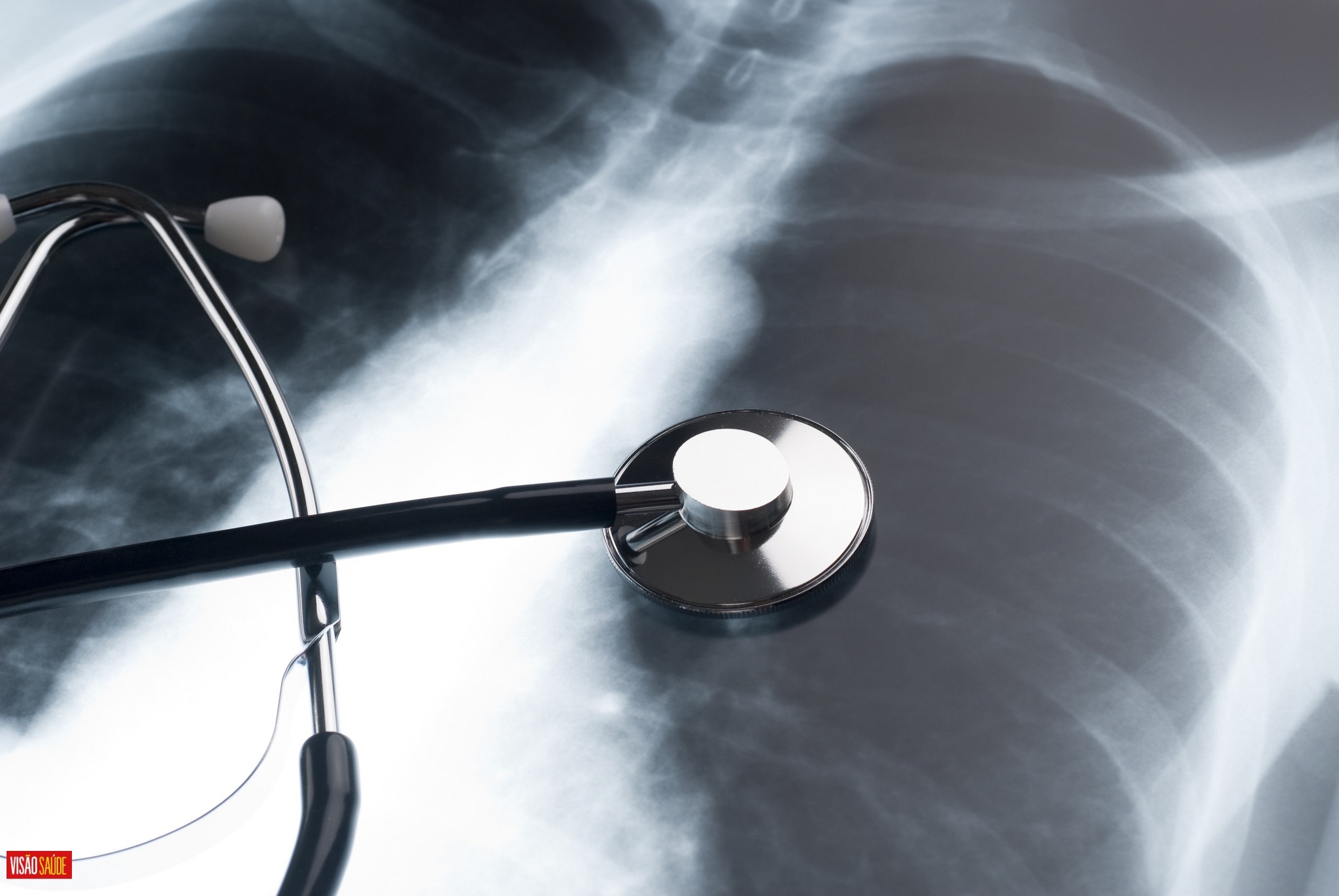 Infeções respiratórias como Covid ou a gripe podem 