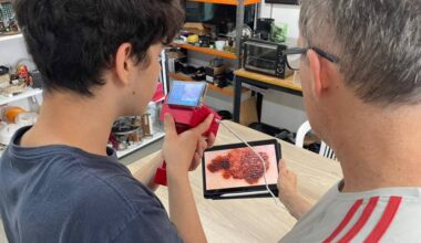 RS: Estudantes criam tecnologia que detecta câncer de pele - 15/01/2026 - Equilíbrio e Saúde