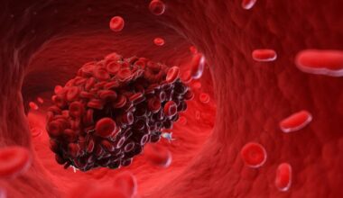 Pequenos coágulos e inflamações podem explicar sintomas persistentes da COVID – Noticias R7