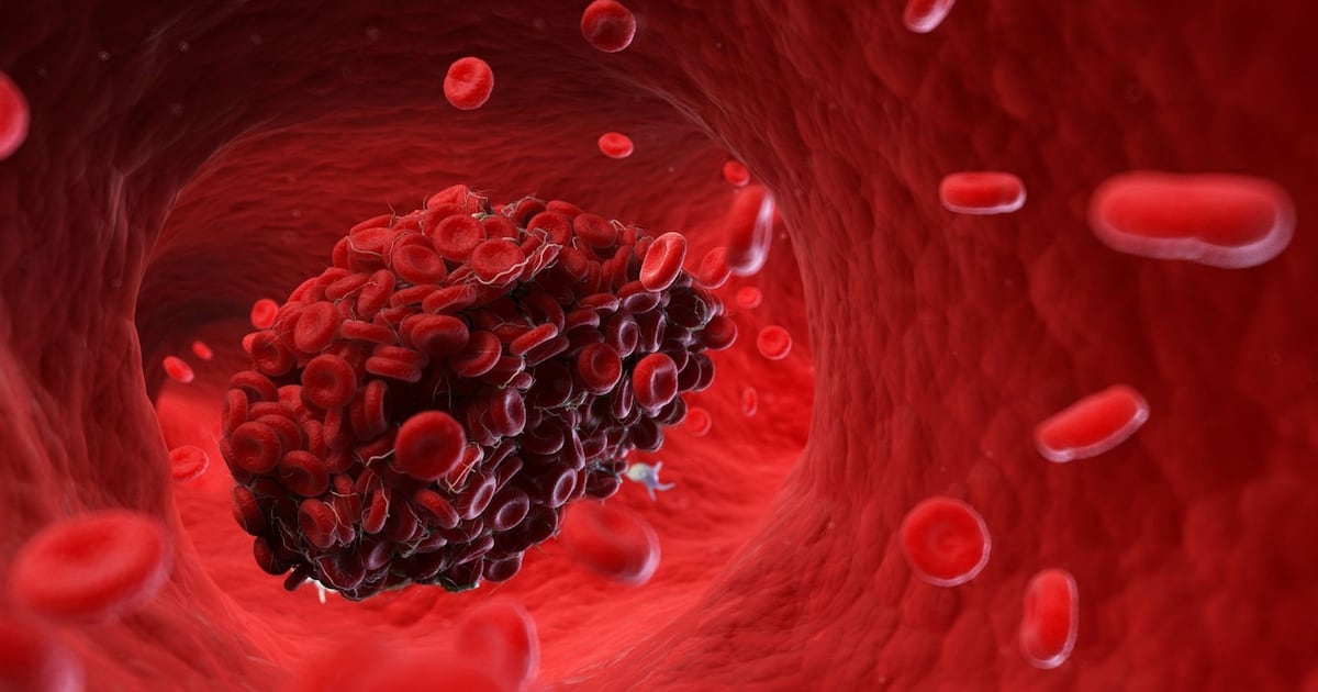 Pequenos coágulos e inflamações podem explicar sintomas persistentes da COVID – Noticias R7