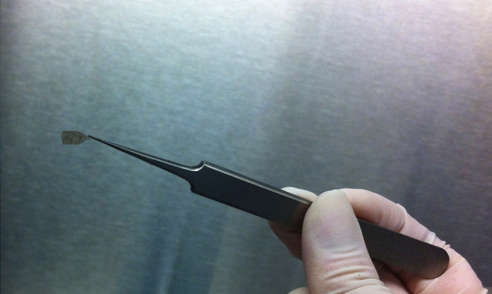 Cientistas testam microimplante ocular mais fino do que fio de cabelo que pode ajudar a restaurar a visão