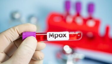 O caso de mpox foi o segundo do clado 1b no Estado -  (crédito: EdiCase)