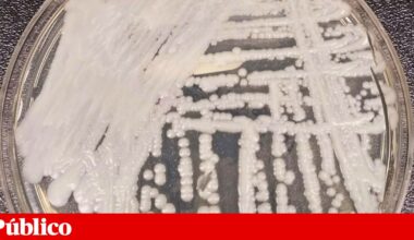 Estudo identifica os primeiros casos de “Candida auris” em Portugal | Saúde