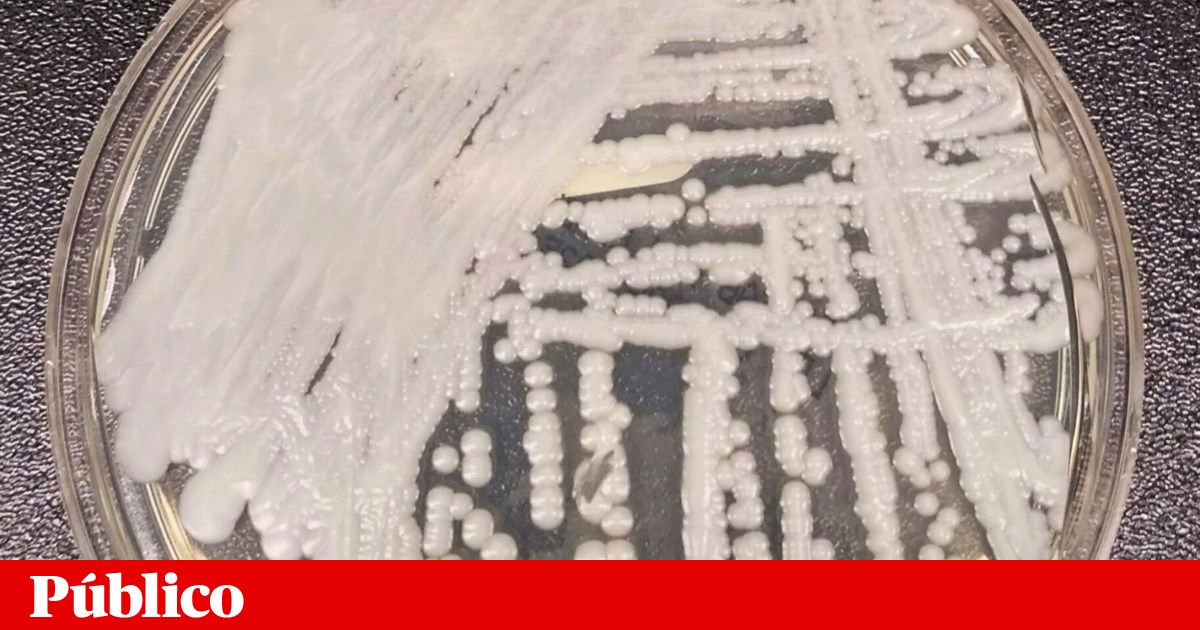Estudo identifica os primeiros casos de “Candida auris” em Portugal | Saúde