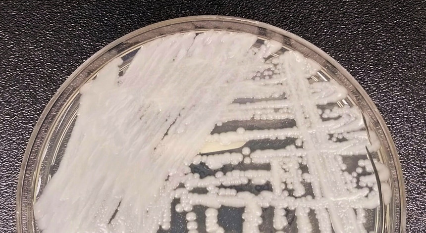 "Candida auris". Fungo resistente e oportunista que se coloniza na pele