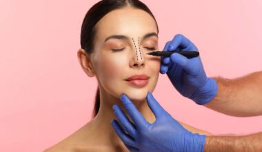 Cirurgias plásticas: por que a procura cresce no verão? - Terra