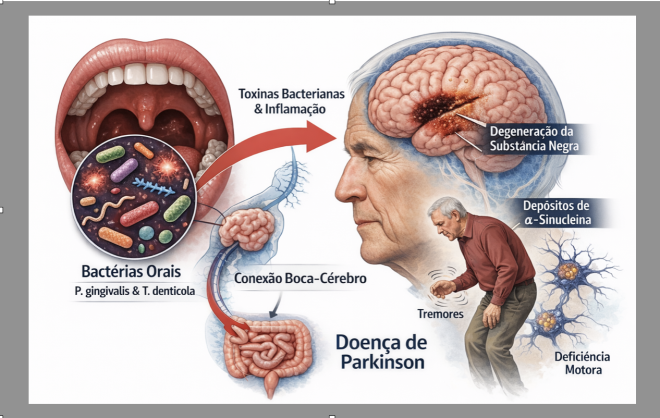 Bactérias orais nocivas podem desencadear a doença de Parkinson