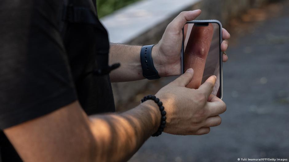 Mpox – a pandemia sobre a qual pouco se fala