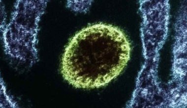 Vírus Nipah reemerge na Índia com dois casos confirmados em Bengala Ocidental