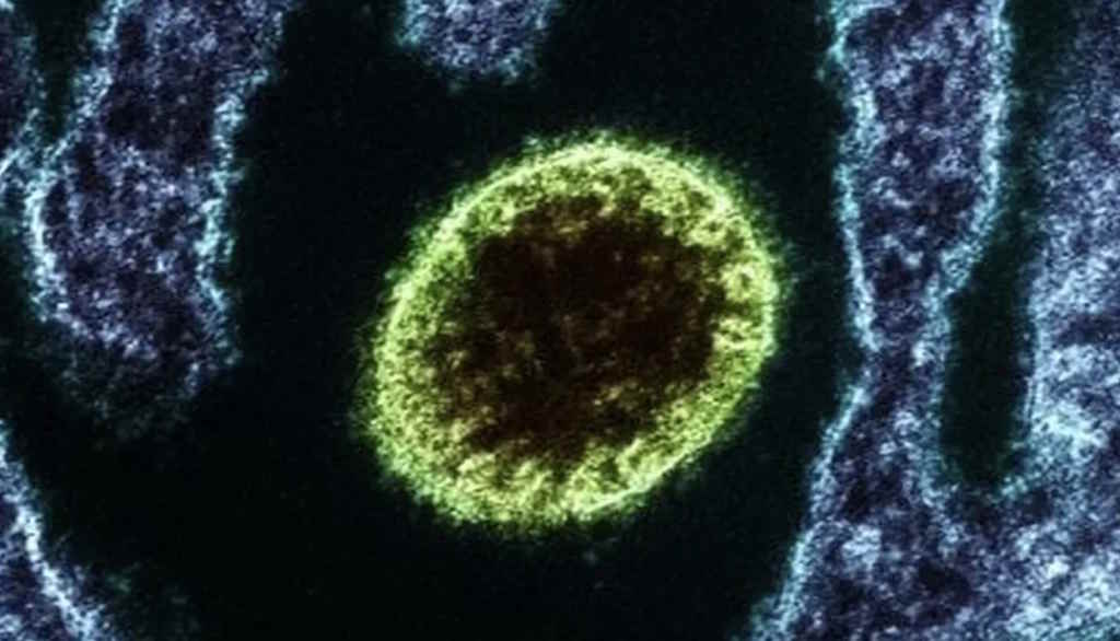 Vírus Nipah reemerge na Índia com dois casos confirmados em Bengala Ocidental