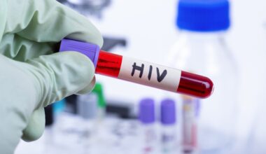 Manaus integra estudo da Fiocruz sobre injeção contra HIV no SUS - G1
