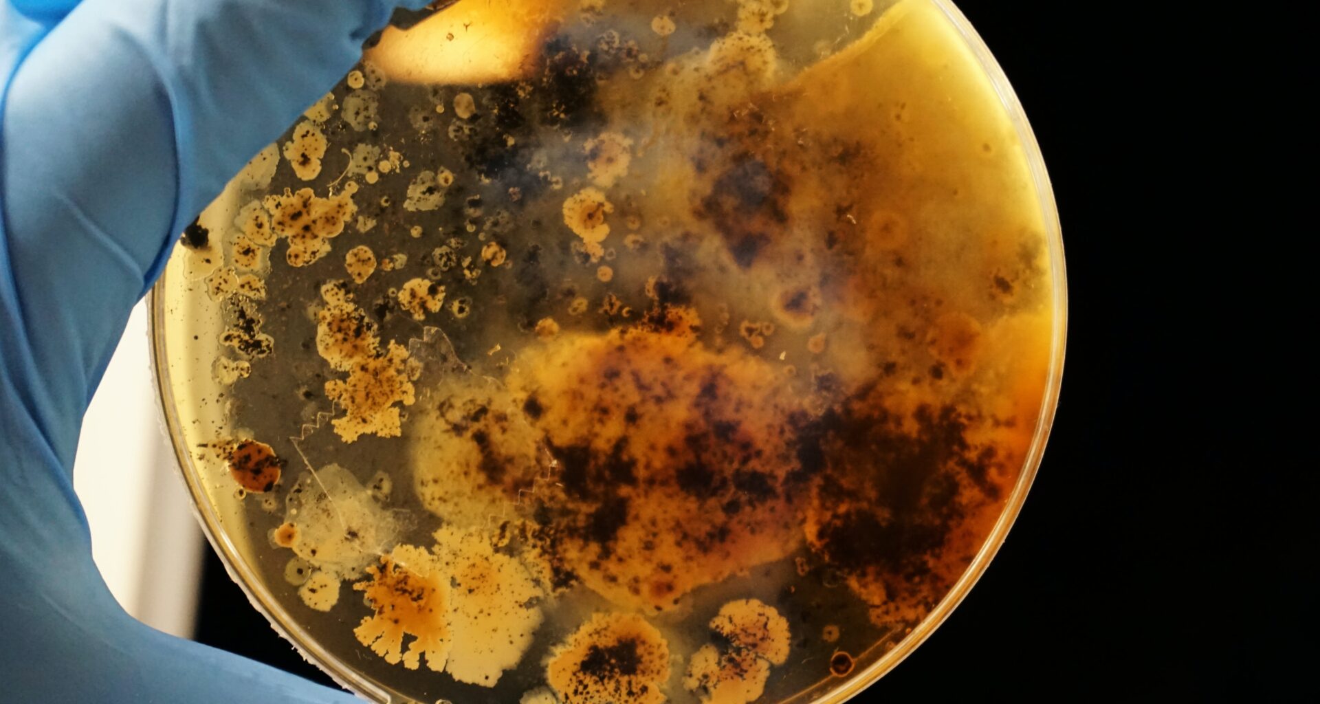 'Bactérias resistentes são um importante problema de saúde pública no Brasil', diz infectologista