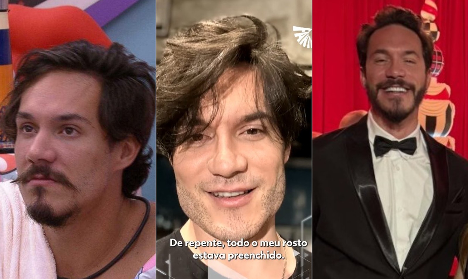 Eliezer saiu do 'BBB 22' e fez procedimentos como redução mamária, lipoaspiração, implante capilar e na barba, rinoplastia, preenchimento do maxilar, colocação de lentes dentais e harmonização facial. Mas, depois, resolveu reverter tudo e passou por uma desarmonização — Foto: Reprodução/TV Globo e Reprodução/Instagram