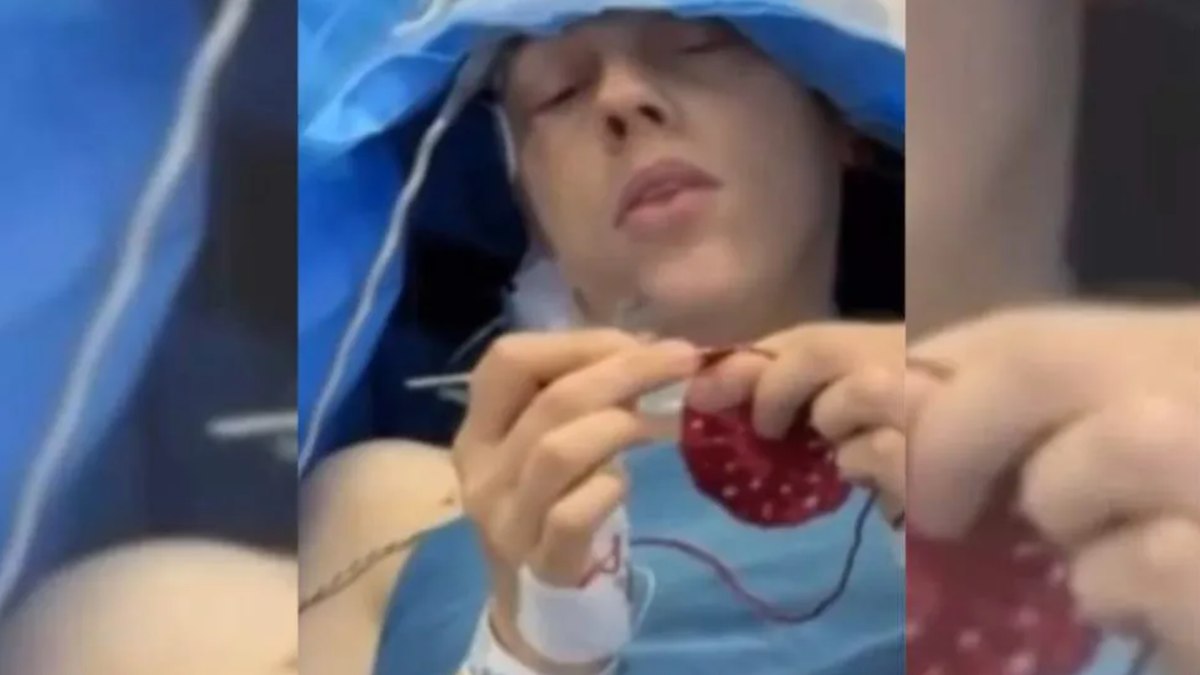 Paciente faz crochê durante cirurgia  no cérebro no Paraná