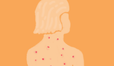 Governo barra vacina da herpes-zóster no SUS: saiba a quem é indicada e quanto custa na rede privada