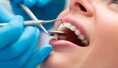 Quem tem os dentes em mau estado tem um risco maior de morrer mais cedo – Notícias de Coimbra