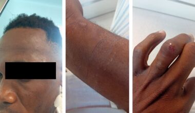 Jovem de São Tomé alega agressão no aeroporto de Lisboa; PSP nega e investiga