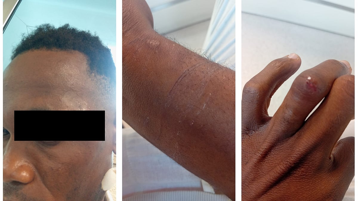 Jovem de São Tomé alega agressão no aeroporto de Lisboa; PSP nega e investiga