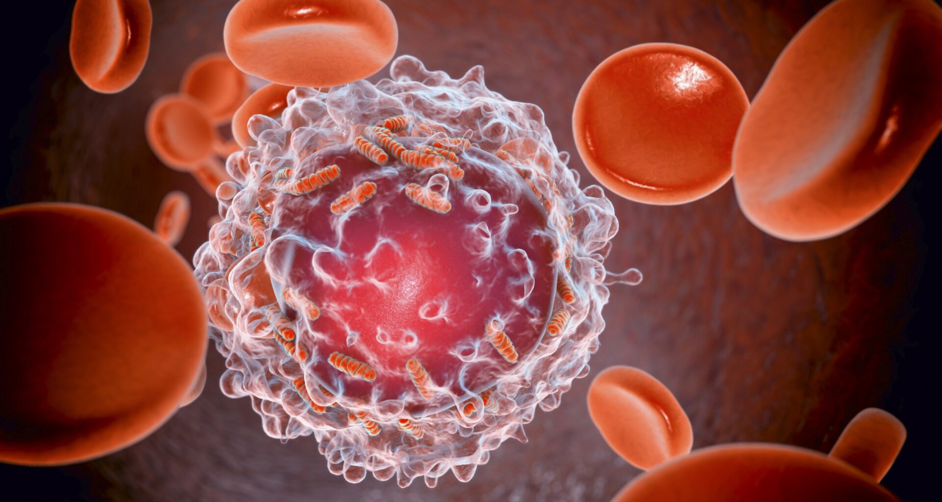 Inteligência artificial identifica células de leucemia no sangue melhor que especialistas