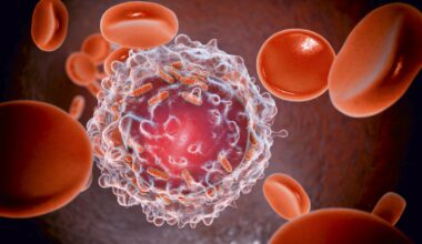 Inteligência artificial identifica células de leucemia no sangue melhor que especialistas