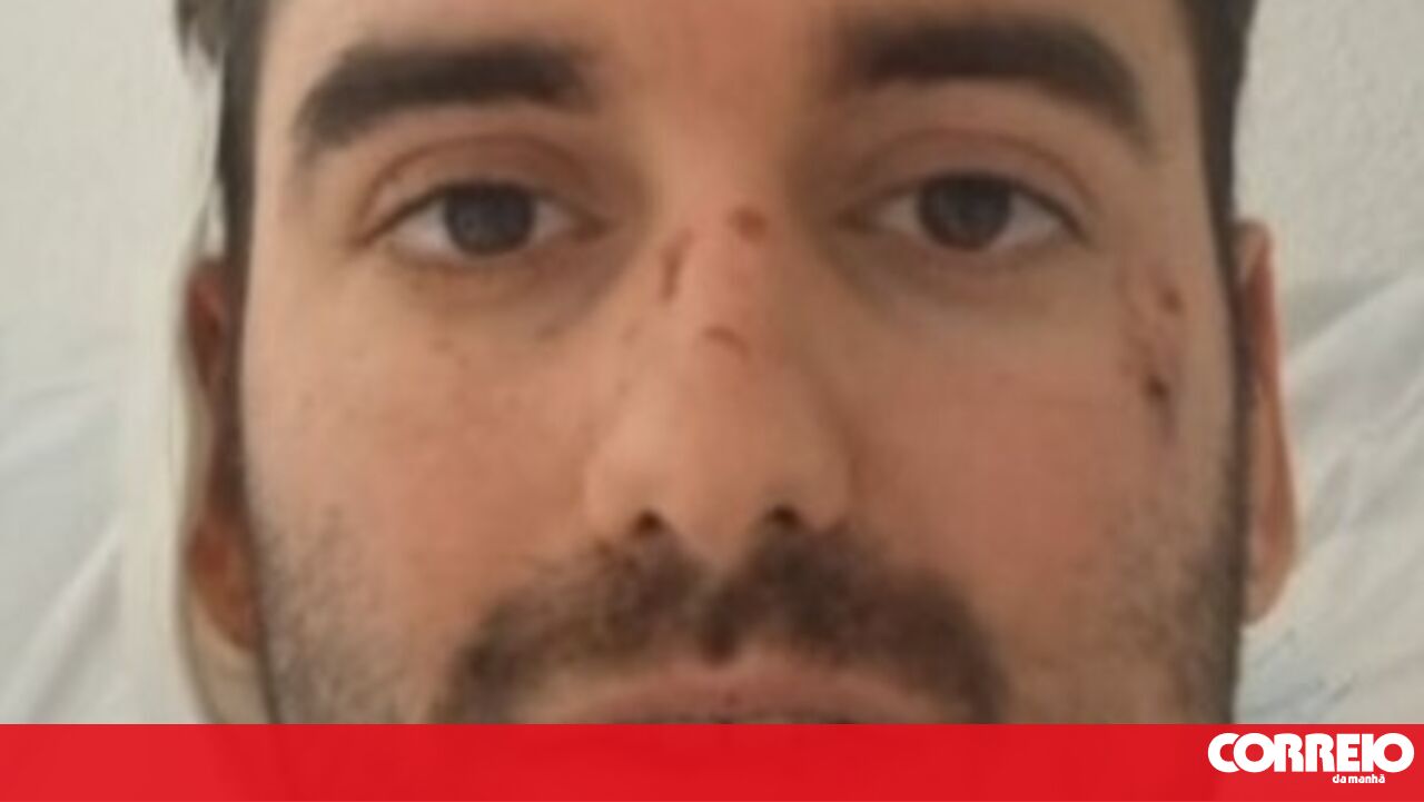 "Por sorte estou vivo": o testemunho do português vítima do desastre ferroviário em Espanha - Mundo