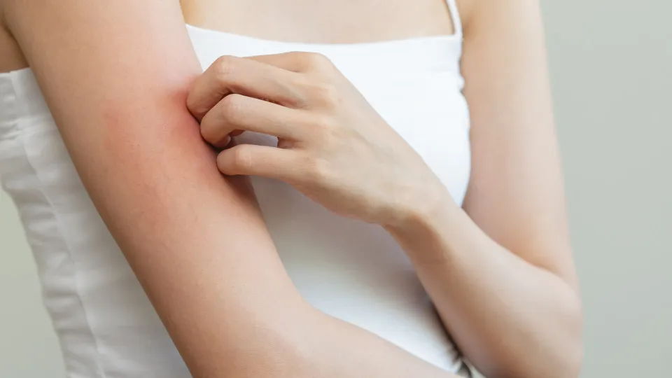 Comichão poderá ser sintoma de 5 tipos de cancro, alerta oncologista