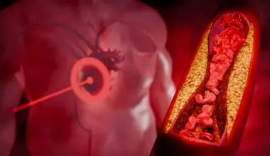 O alimento barato que ajuda a reduzir o colesterol em 4 semanas