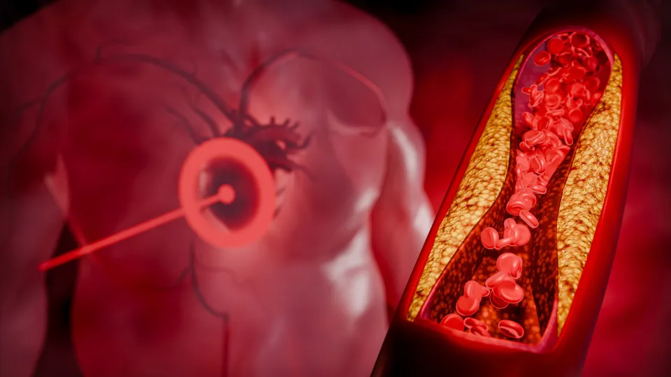 O alimento barato que ajuda a reduzir o colesterol em 4 semanas