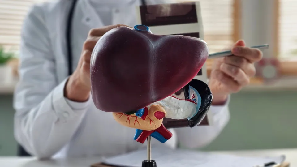 Os sintomas silenciosos da gordura no fígado, alerta endocrinologista