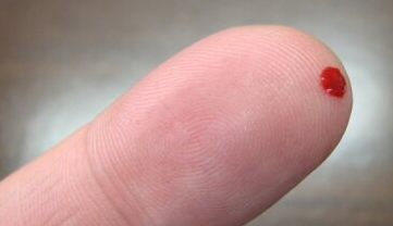 Gota de sangue da ponta do dedo pode detetar Alzheimer