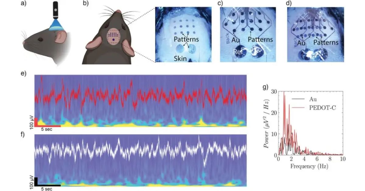 Sensores impressos na pele permitem uma captação mais precisa dos sinais cerebrais