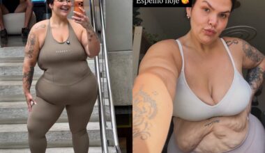 Thais Carla celebra nova fase após cirurgia bariátrica e revela detalhes da transformação corporal