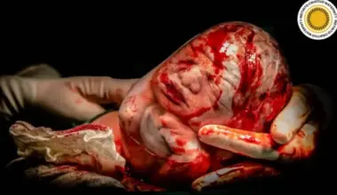 Bebê empelicado: fotógrafa mineira recebe maior média em concurso de fotografia sobre parto