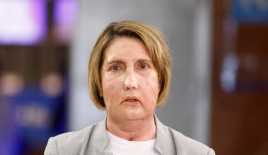 Hospital espanhol faz transplante de cara de doadora que pediu eutanásia pela primeira vez no mundo