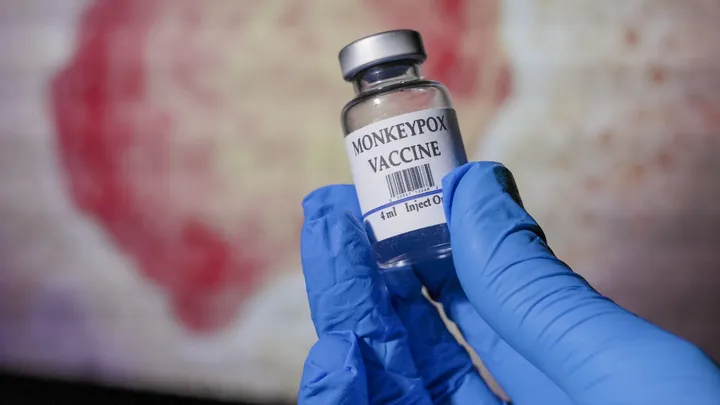 Monkeypox: uma preocupação (cada vez mais) à escala global