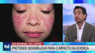 O corpo começa a atacar-se a si próprio: estes são os sinais de uma doença que afeta sobretudo mulhe