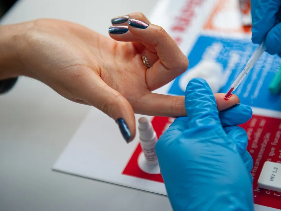 Estudo mostra que 84% dos pacientes com diagnóstico tardio de HIV são heterossexuais
