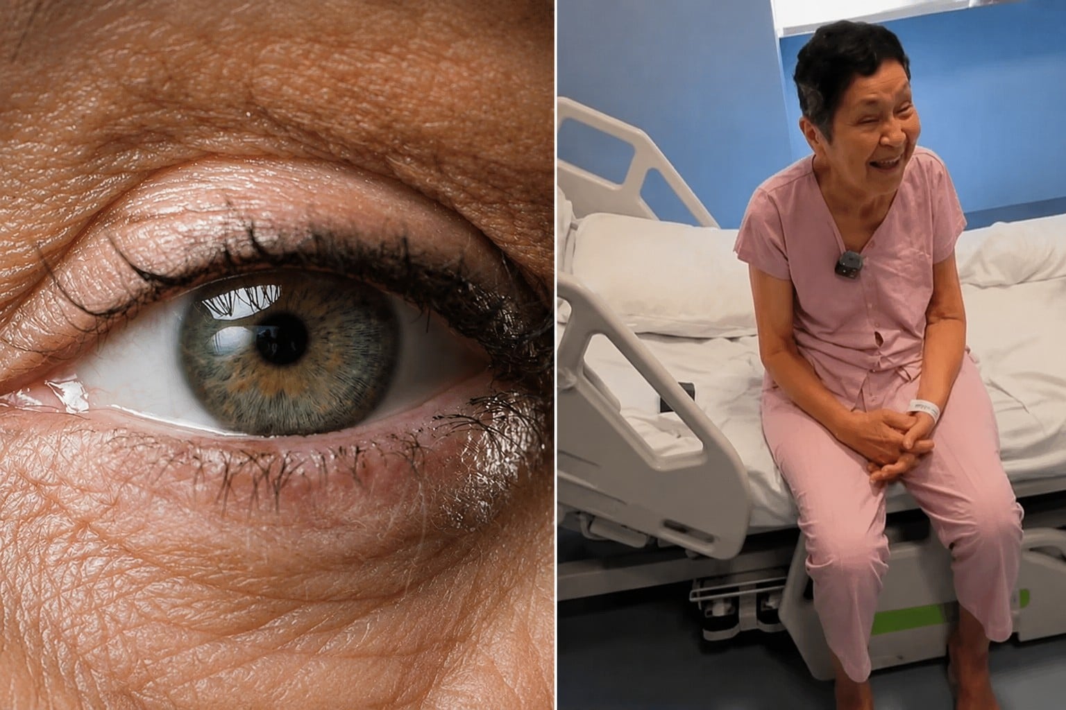 Transplante inédito de mácula recupera visão de mulher de 67