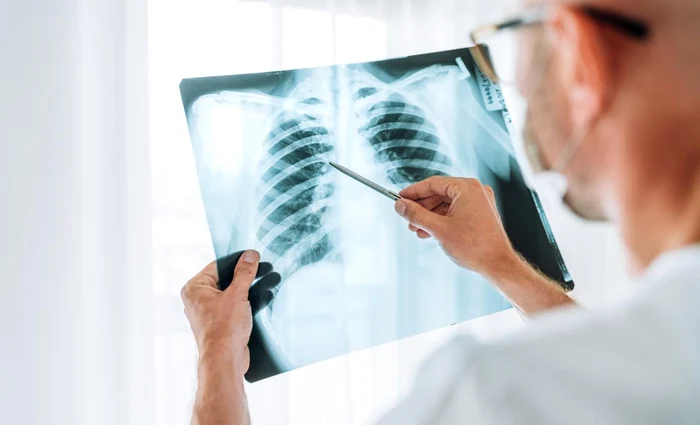 Microplastice descoperite adânc în oasele umane FOTO: Arhivă