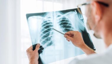 Pericolul care ne invadează corpul: descoperire surprinzătoare în oasele umane